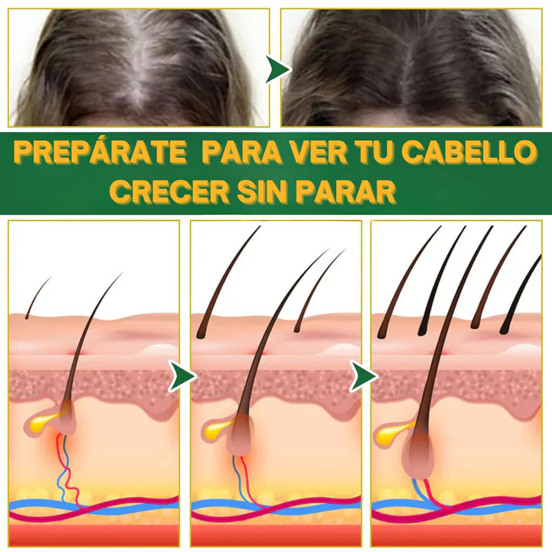 Tratamiento Completo - Shampoo + acondiconador + Tonico OUHOE