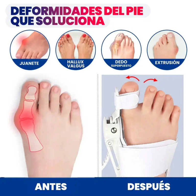 CORRECTOR DE JUANETE 2X1 ORTOPÉDICO
